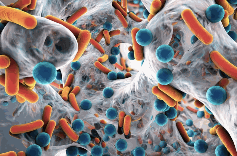Infection